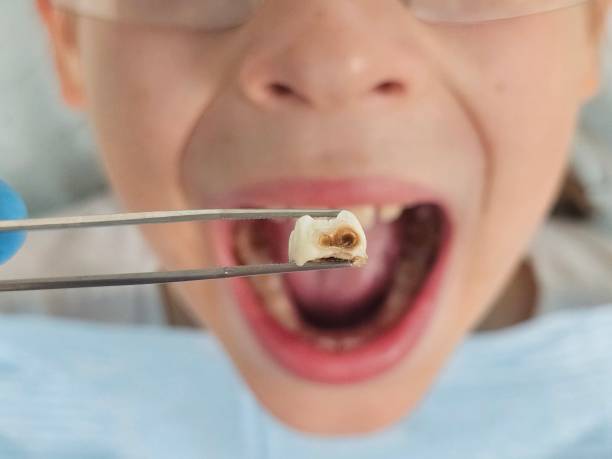 Best Walk-In Emergency Dental Services in Burton, MI